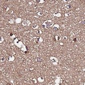 Anti-NAXE antibody produced in rabbit Prestige Antibodies® Powered by Atlas Antibodies, affinity isolated antibody, buffered aqueous glycerol solution