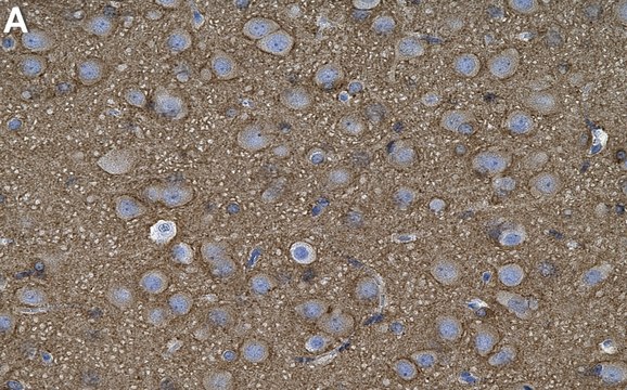 Anti-Tau Antibody, clone T49 ZooMAb&#174; Mouse Monoclonal recombinant, expressed in HEK 293 cells