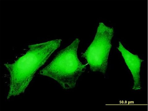 Monoclonal Anti-ASPA antibody produced in mouse clone 3C11, purified immunoglobulin, buffered aqueous solution