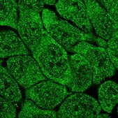 Anti-MCTP2 antibody produced in rabbit Prestige Antibodies® Powered by Atlas Antibodies, affinity isolated antibody, buffered aqueous glycerol solution