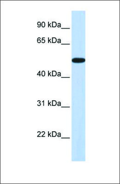 Anti-HOXA3 antibody produced in rabbit affinity isolated antibody