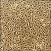 Bovine Pulmonary Artery Endothelial Cells: BPAEC (Cryovial)