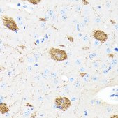 Anti- APP antibody produced in rabbit