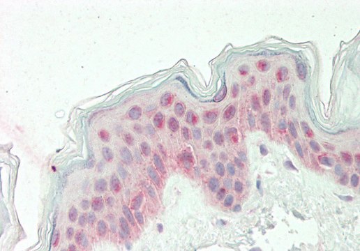 Anti-KLF10 antibody produced in rabbit affinity isolated antibody