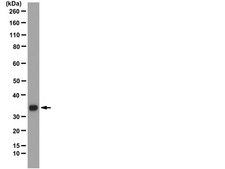 Anti-SMN Antibody, clone 62E7 clone 62E7, from mouse
