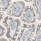 Anti-PIK3CA antibody produced in rabbit Prestige Antibodies® Powered by Atlas Antibodies, affinity isolated antibody, buffered aqueous glycerol solution