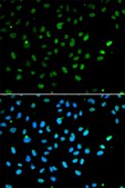 Anti-SMARCA4 antibody produced in rabbit affinity isolated antibody