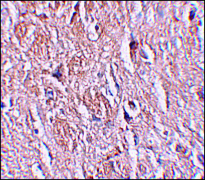 Anti-LRRTM4 antibody produced in rabbit affinity isolated antibody