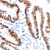 Anti-SATB2 Antibody, clone 3F9E1, Rabbit Monoclonal