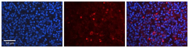 Anti-USF1 antibody produced in rabbit affinity isolated antibody