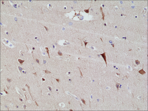 Anti-PSD-95 antibody, Rabbit Monoclonal recombinant, expressed in HEK 293 cells, clone RM288, purified immunoglobulin