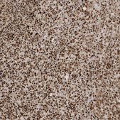 Anti-CKS2 antibody produced in rabbit Prestige Antibodies® Powered by Atlas Antibodies, affinity isolated antibody, buffered aqueous glycerol solution