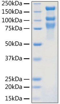 Recombinant 2019-nCoV S1+S2 ECD (S-ECD) Protein with His tag