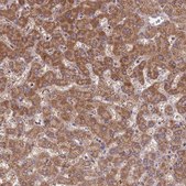 Anti-ST3GAL3 antibody produced in rabbit Prestige Antibodies® Powered by Atlas Antibodies, affinity isolated antibody, buffered aqueous glycerol solution