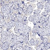 Anti-NLRP14 antibody produced in rabbit Prestige Antibodies® Powered by Atlas Antibodies, affinity isolated antibody, buffered aqueous glycerol solution