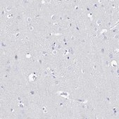 Anti-UGDH antibody produced in rabbit Prestige Antibodies® Powered by Atlas Antibodies, affinity isolated antibody, buffered aqueous glycerol solution