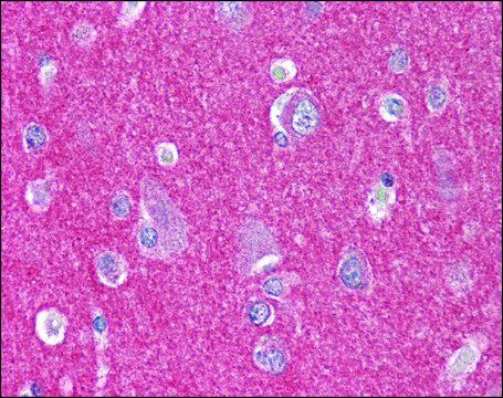 Anti-ARHGEF17 / TEM4 antibody produced in rabbit affinity isolated antibody