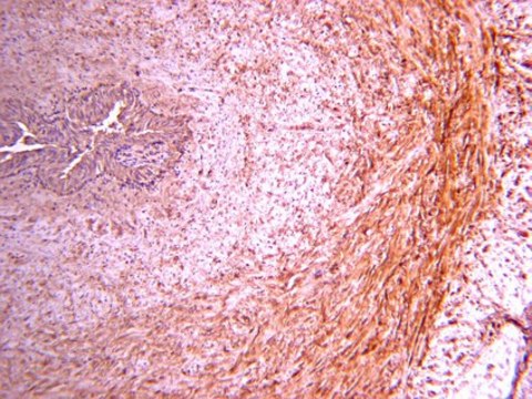 Anti-Procollagen Type III PIIINP Antibody Chemicon&#174;, from rabbit