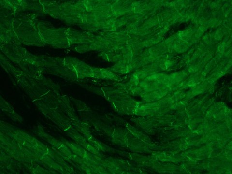 Monoclonal Anti-Plectin antibody produced in mouse clone 7A8, ascites fluid