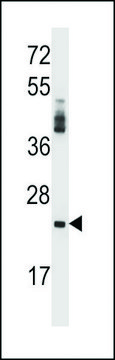 ANTI-PRSS2 (CENTER) antibody produced in rabbit affinity isolated antibody, buffered aqueous solution