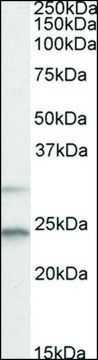 Anti-MAD2L1 (C-terminal) antibody produced in goat affinity isolated antibody, buffered aqueous solution