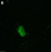 Anti-pan-Na+ Channel Antibody, clone 4B8 ZooMAb® Rabbit Monoclonal recombinant, expressed in HEK 293 cells
