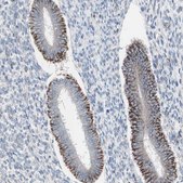 Anti-AGPAT5 antibody produced in rabbit Prestige Antibodies® Powered by Atlas Antibodies, affinity isolated antibody, buffered aqueous glycerol solution