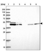 Anti-DDX49 antibody produced in rabbit Prestige Antibodies® Powered by Atlas Antibodies, affinity isolated antibody, buffered aqueous glycerol solution