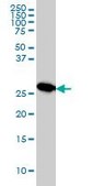 Monoclonal Anti-MTAP antibody produced in mouse clone 2G4, purified immunoglobulin, buffered aqueous solution