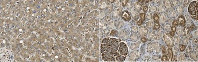 Anti-Acetyl CoA Carboxylase 1 from rabbit, purified by affinity chromatography