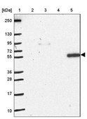 Anti-NOS1AP antibody produced in rabbit Prestige Antibodies® Powered by Atlas Antibodies, affinity isolated antibody, buffered aqueous glycerol solution