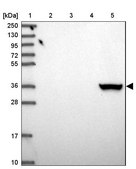 Anti-AKR1C4 antibody produced in rabbit Prestige Antibodies® Powered by Atlas Antibodies, affinity isolated antibody, buffered aqueous glycerol solution