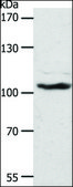 Anti-ADAMTS17 antibody produced in rabbit affinity isolated antibody