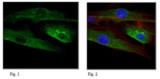 Anti-Gamma-1-Tubulin, clone 6H3.1 Antibody clone 6H3.1, from mouse