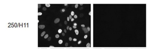 Anti-Progesterone Receptor B Antibody, clone 250/H11 clone 250/H11, from mouse