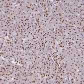 Anti-IRF2BPL antibody produced in rabbit Prestige Antibodies® Powered by Atlas Antibodies, affinity isolated antibody, buffered aqueous glycerol solution