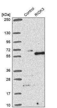 Anti-RIOK3 antibody produced in rabbit Prestige Antibodies&#174; Powered by Atlas Antibodies, affinity isolated antibody, buffered aqueous glycerol solution