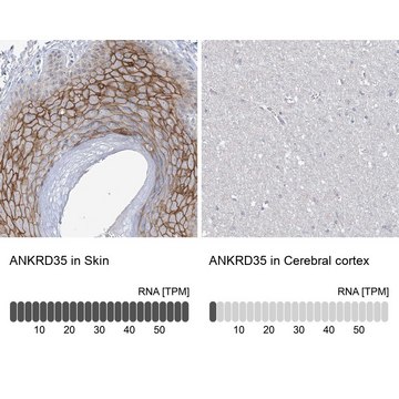 Anti-ANKRD35 antibody produced in rabbit Prestige Antibodies&#174; Powered by Atlas Antibodies, affinity isolated antibody, buffered aqueous glycerol solution