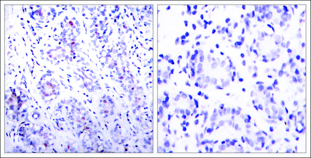 Anti-STAT3 (Ab-727) antibody produced in rabbit affinity isolated antibody