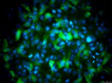 B16-OVA MO4 Mouse Melanoma Cell Line