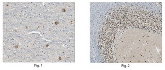 Anti-GluR1 Antibody from rabbit, purified by affinity chromatography