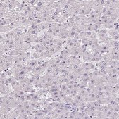 Anti-AKR1E2 antibody produced in rabbit Prestige Antibodies® Powered by Atlas Antibodies, affinity isolated antibody, buffered aqueous glycerol solution
