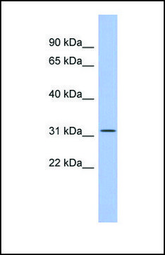 Anti-SPIB antibody produced in rabbit affinity isolated antibody