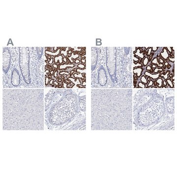 Anti-CSN3 antibody produced in rabbit Prestige Antibodies&#174; Powered by Atlas Antibodies, affinity isolated antibody