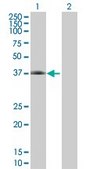 Anti-CFHR1 antibody produced in mouse IgG fraction of antiserum, buffered aqueous solution