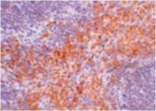 Anti-RIPK1 Antibody from rabbit, purified by affinity chromatography