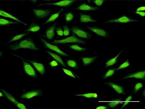 Anti-IGFBP3 antibody produced in rabbit purified immunoglobulin, buffered aqueous solution