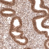 Anti-BTBD7 antibody produced in rabbit Prestige Antibodies® Powered by Atlas Antibodies, affinity isolated antibody, buffered aqueous glycerol solution