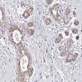 Anti-EHF antibody produced in rabbit Prestige Antibodies® Powered by Atlas Antibodies, affinity isolated antibody, buffered aqueous glycerol solution