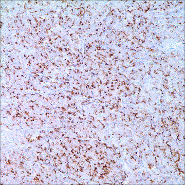 GCDFP-15 (EP1582Y) Rabbit Monoclonal Primary Antibody